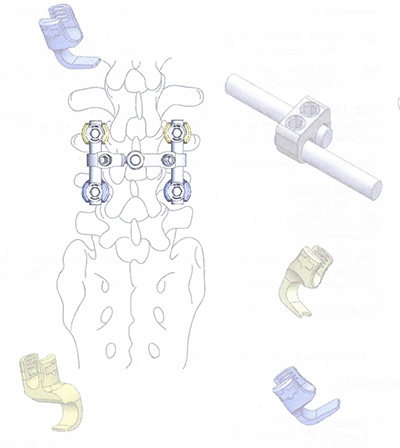 Spinal Hook System
