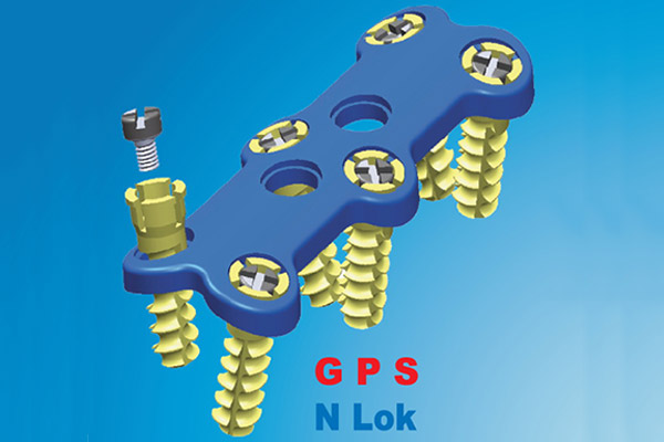 nlok