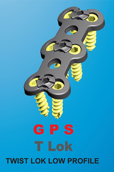 gps-tlok