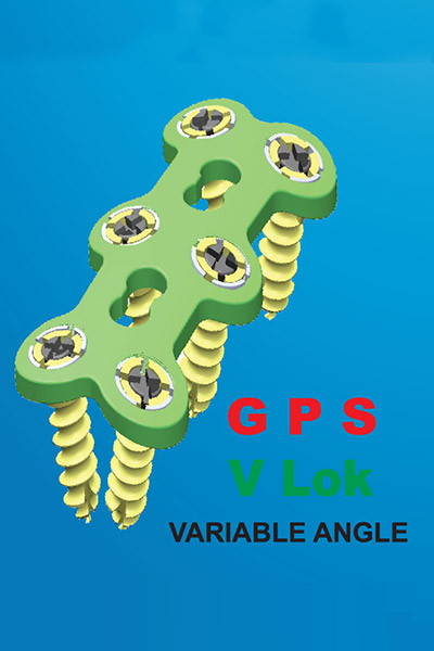 gps-vlok